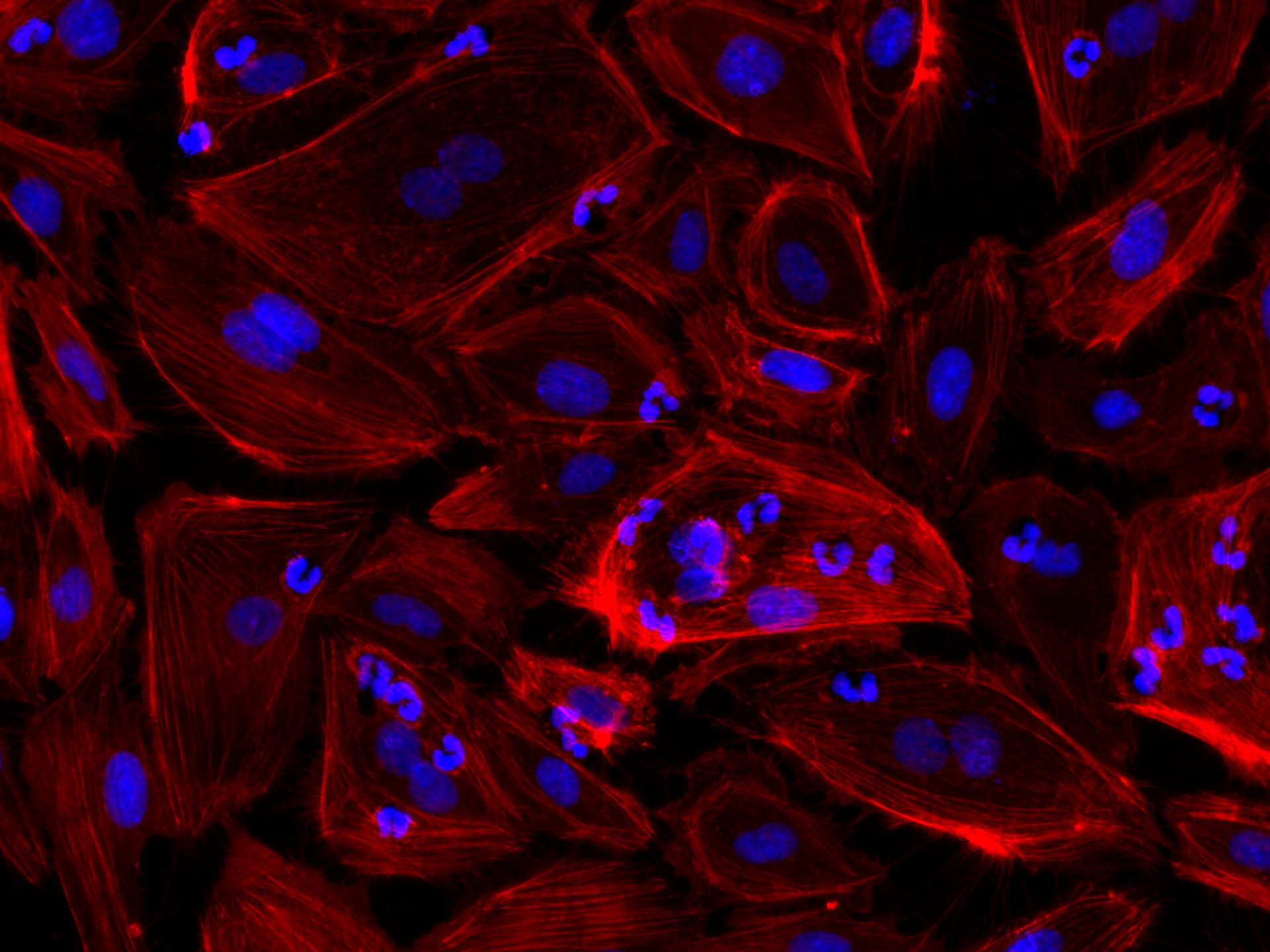 Stimulated endothelial cells treated with neutrophils